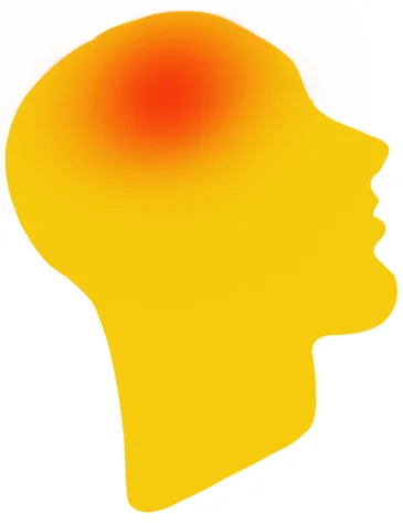 Headache-NHSneurocarepic-Dr-Sandeep-Goel-Best-Neurologist-in-Jalandhar,Punjab,India
