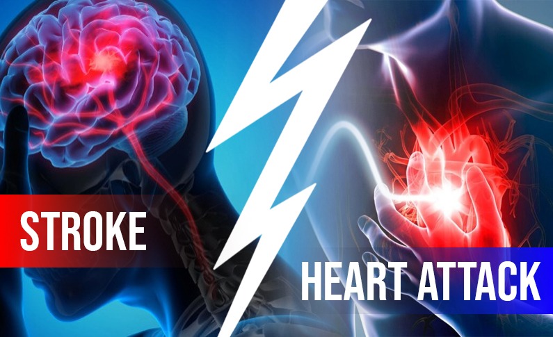 Stroke vs. Heart Attack: Understanding the Differences